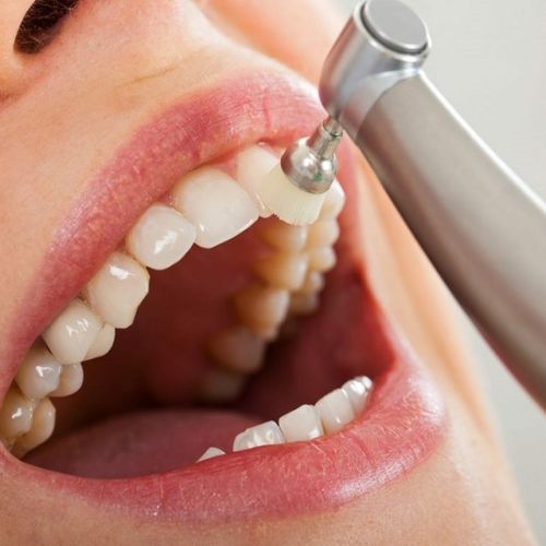 Dental Cleaning