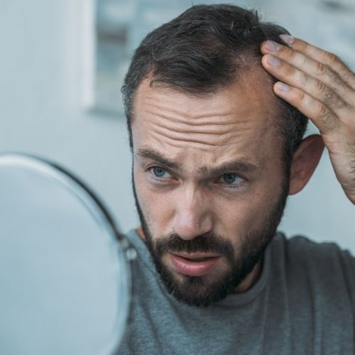 Hair Loss and Genetics: What You Need to Know